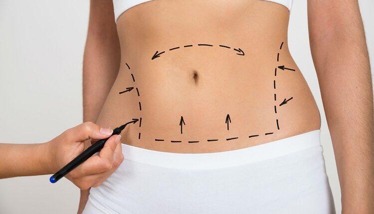 Tightening Loose Skin