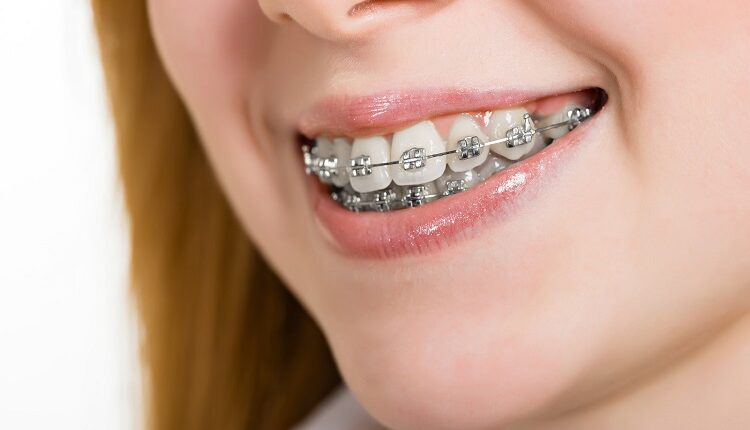 Orthodontics