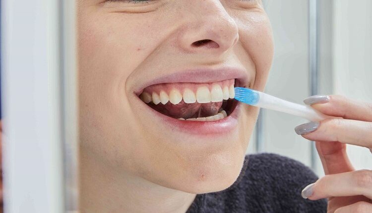 Teeth Bleaching