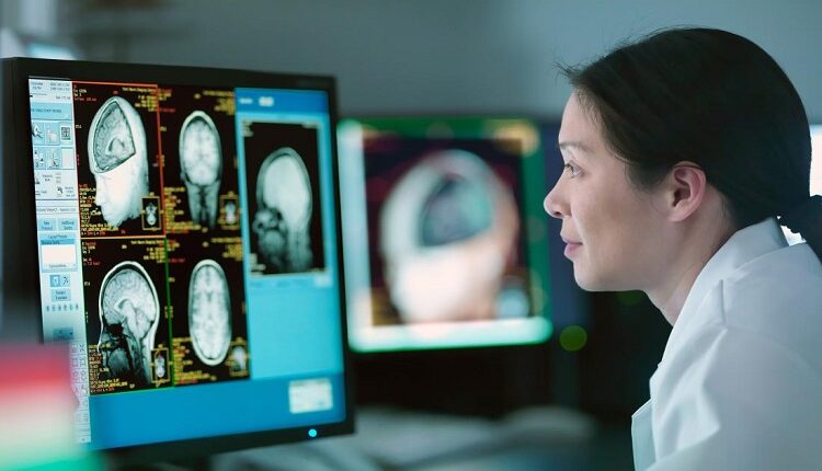 Neurologists